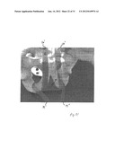 IMPLANTABLE DEVICES FOR THE TREATMENT OF INCONTINENCE AND METHODS OF USING     SAME diagram and image