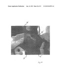 IMPLANTABLE DEVICES FOR THE TREATMENT OF INCONTINENCE AND METHODS OF USING     SAME diagram and image