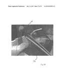 IMPLANTABLE DEVICES FOR THE TREATMENT OF INCONTINENCE AND METHODS OF USING     SAME diagram and image