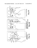 SURGICAL ARTICLES AND METHODS diagram and image