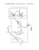 SURGICAL ARTICLES AND METHODS diagram and image