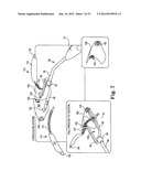 SURGICAL ARTICLES AND METHODS diagram and image