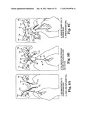 SURGICAL ARTICLES AND METHODS diagram and image