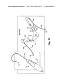 SURGICAL ARTICLES AND METHODS diagram and image