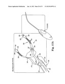 SURGICAL ARTICLES AND METHODS diagram and image