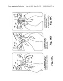 SURGICAL ARTICLES AND METHODS diagram and image