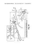 SURGICAL ARTICLES AND METHODS diagram and image