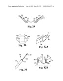 SURGICAL ARTICLES AND METHODS diagram and image