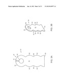 PELVIC IMPLANT WITH SUSPENDING SYSTEM diagram and image