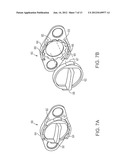 PELVIC IMPLANT WITH SUSPENDING SYSTEM diagram and image