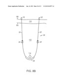 PELVIC IMPLANT WITH SUSPENDING SYSTEM diagram and image