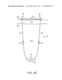 PELVIC IMPLANT WITH SUSPENDING SYSTEM diagram and image