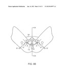 PELVIC IMPLANT WITH SUSPENDING SYSTEM diagram and image