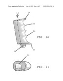 Access Device for Surgery diagram and image