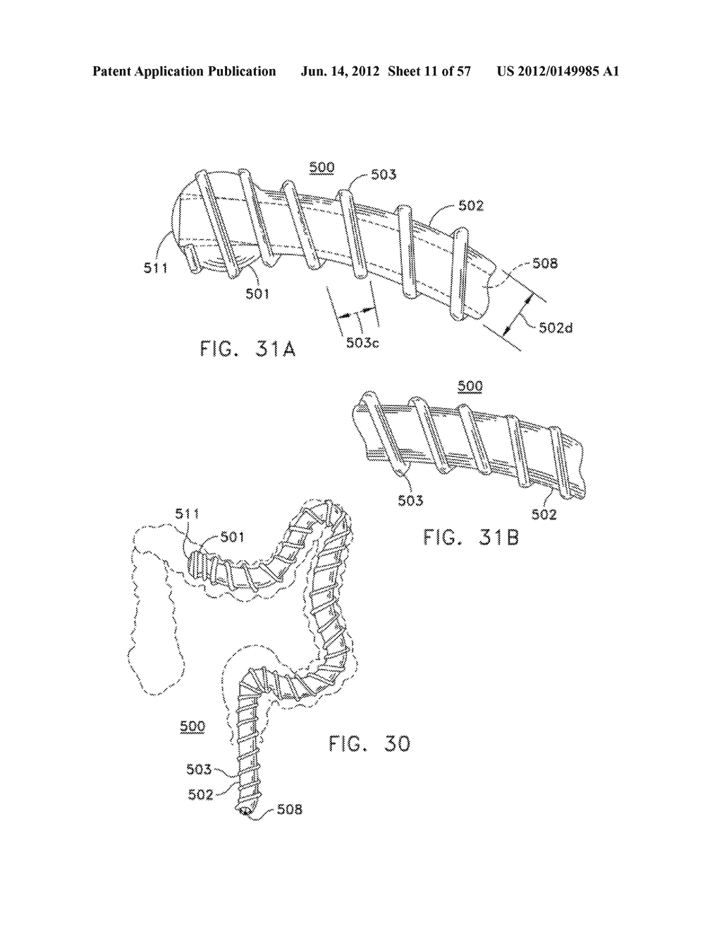 ROTATE-TO-ADVANCE CATHETERIZATION SYSTEM - diagram, schematic, and image 12