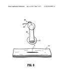 SEAL ANCHOR FOR USE IN SURGICAL PROCEDURES diagram and image