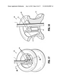 SEAL ANCHOR FOR USE IN SURGICAL PROCEDURES diagram and image