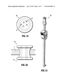 SEAL ANCHOR FOR USE IN SURGICAL PROCEDURES diagram and image