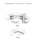 DEVICES FOR PERFORMING BLEPHAROPLASTY AND METHODS OF USING THE SAME diagram and image