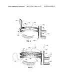 DEVICES FOR PERFORMING BLEPHAROPLASTY AND METHODS OF USING THE SAME diagram and image