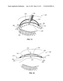 DEVICES FOR PERFORMING BLEPHAROPLASTY AND METHODS OF USING THE SAME diagram and image