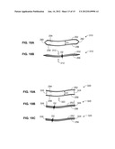 DEVICES FOR PERFORMING BLEPHAROPLASTY AND METHODS OF USING THE SAME diagram and image