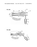 DEVICES FOR PERFORMING BLEPHAROPLASTY AND METHODS OF USING THE SAME diagram and image