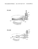 DEVICES FOR PERFORMING BLEPHAROPLASTY AND METHODS OF USING THE SAME diagram and image