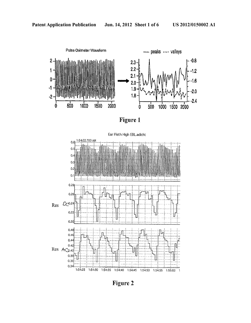 Systems and Methods Utilizing Plethysmographic Data for Distinguishing     Arterial and Venous Saturations - diagram, schematic, and image 02