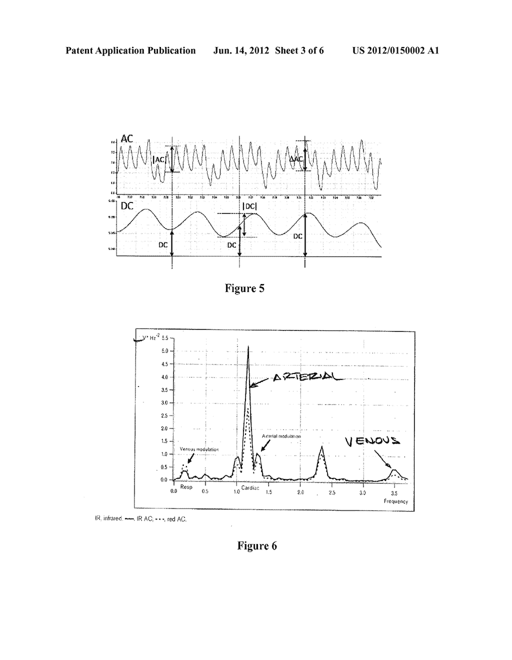 Systems and Methods Utilizing Plethysmographic Data for Distinguishing     Arterial and Venous Saturations - diagram, schematic, and image 04