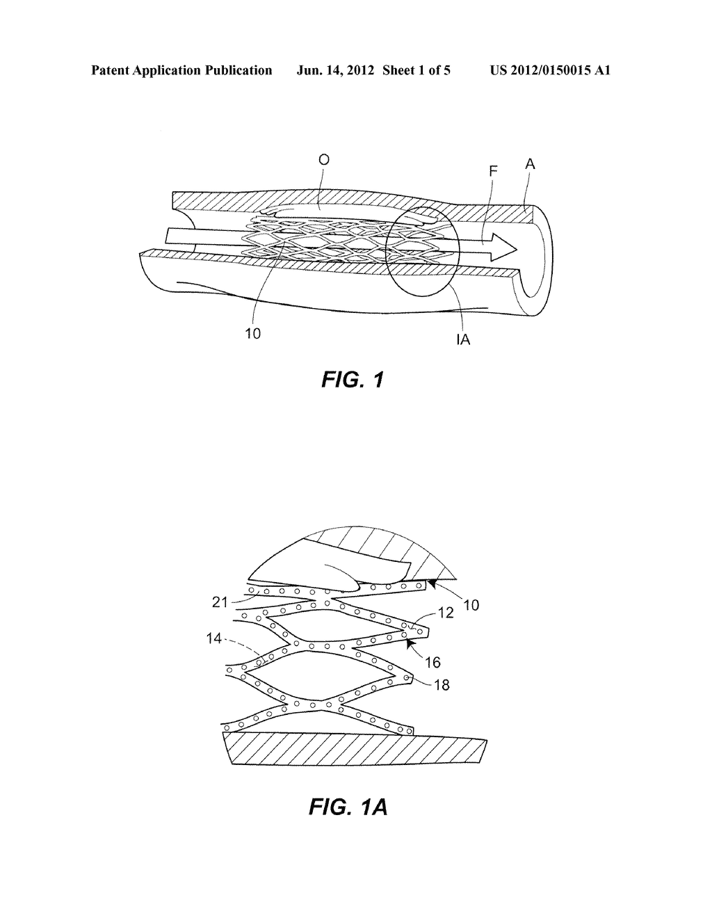 SYSTEM AND METHOD FOR DETECTING HEALING ADJACENT TO IMPLANTED MEDICAL     DEVICE - diagram, schematic, and image 02