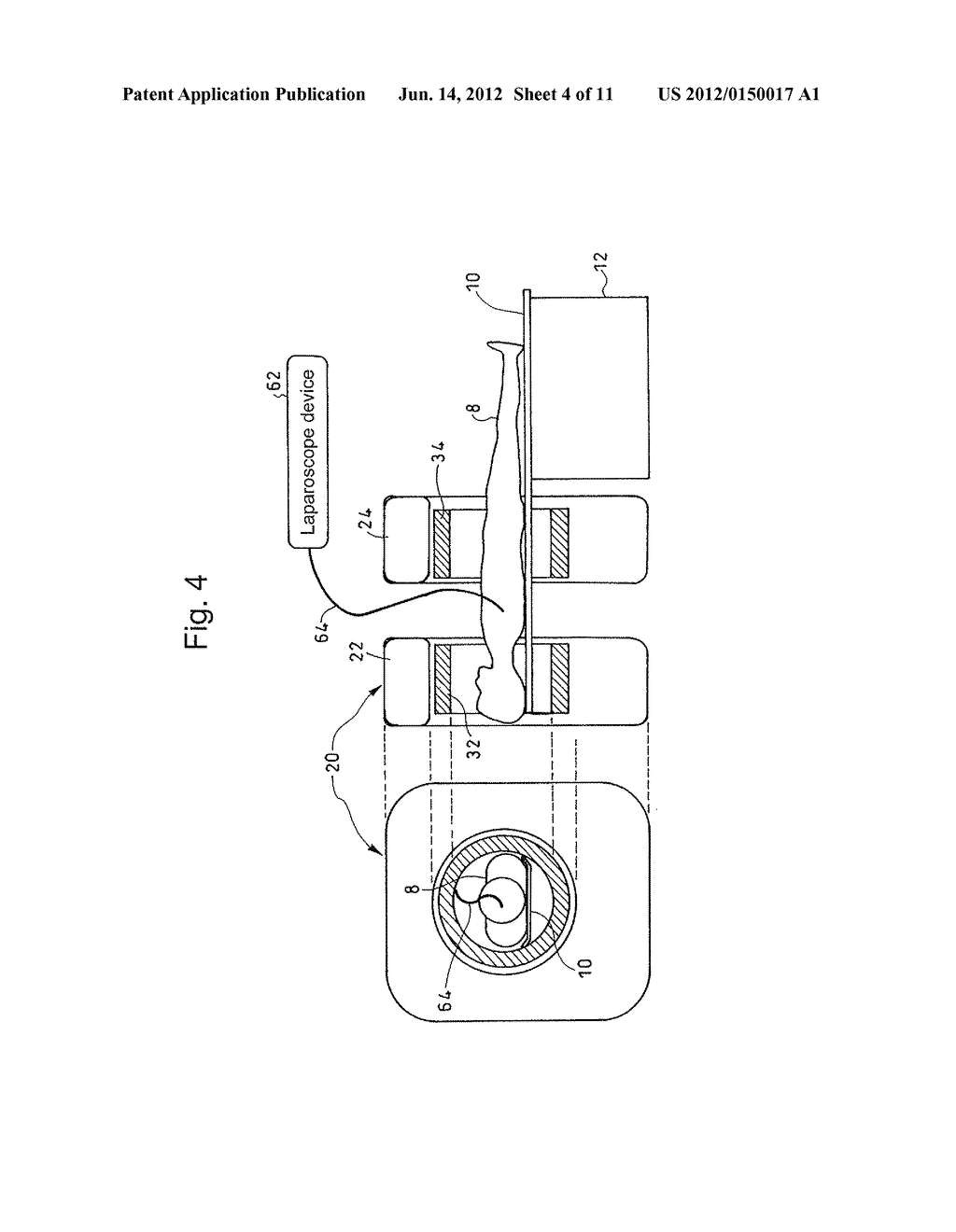 OPEN PET/MRI HYBRID MACHINE - diagram, schematic, and image 05