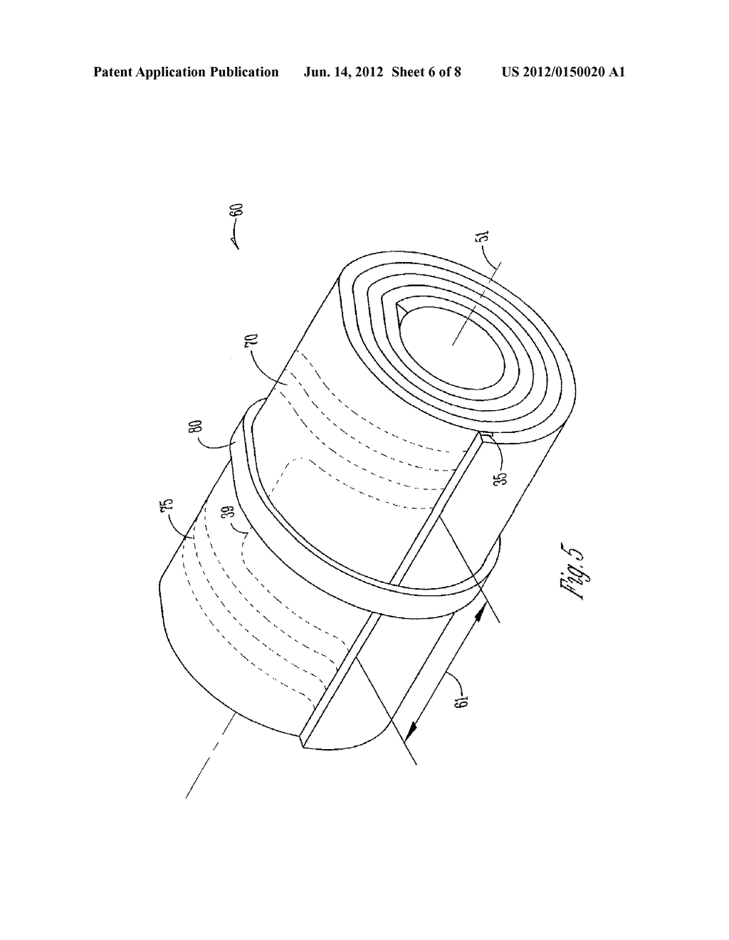 Microcoil Construction - diagram, schematic, and image 07