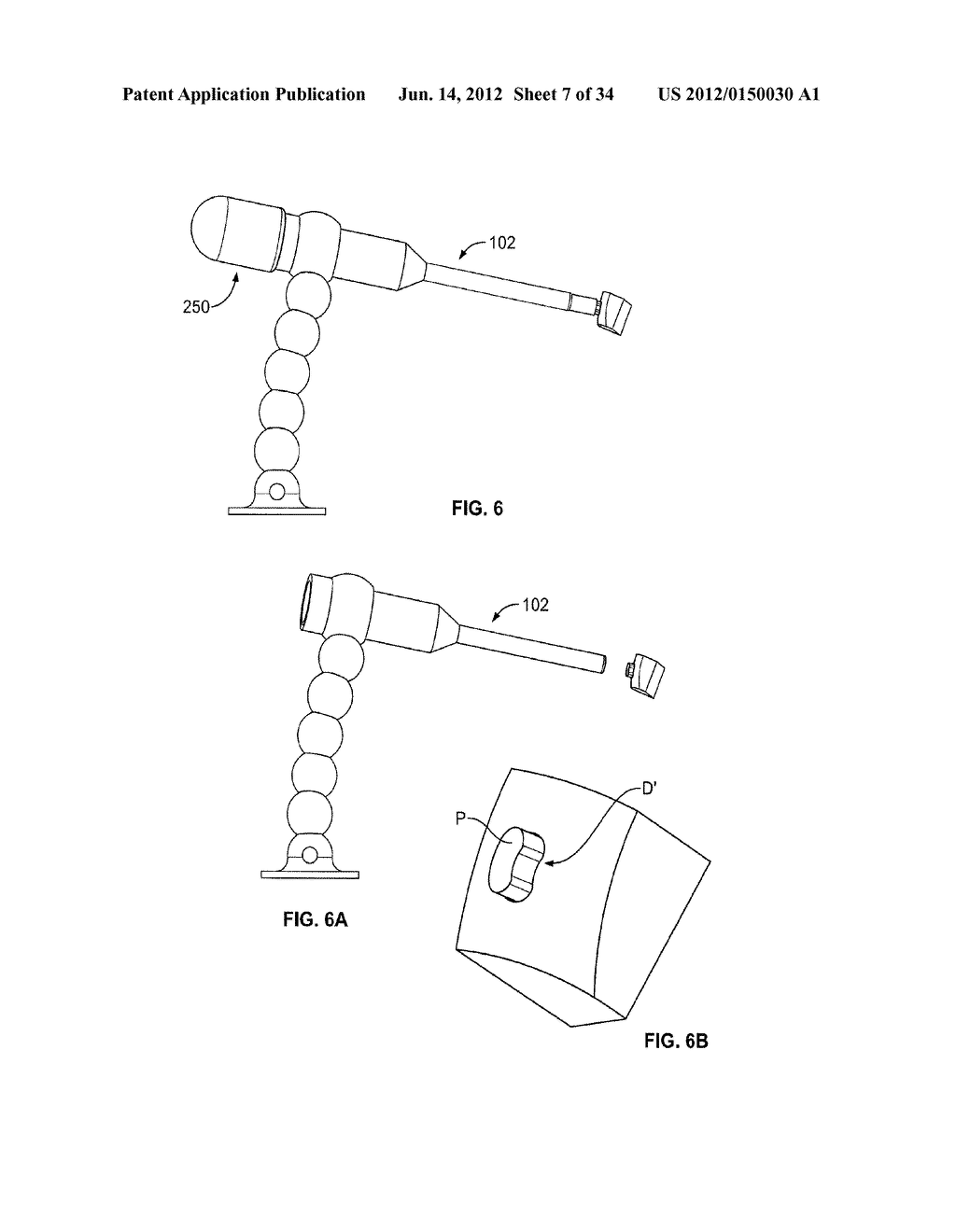 Instruments, Methods and Systems for Harvesting and Implanting Cartilage     Material - diagram, schematic, and image 08