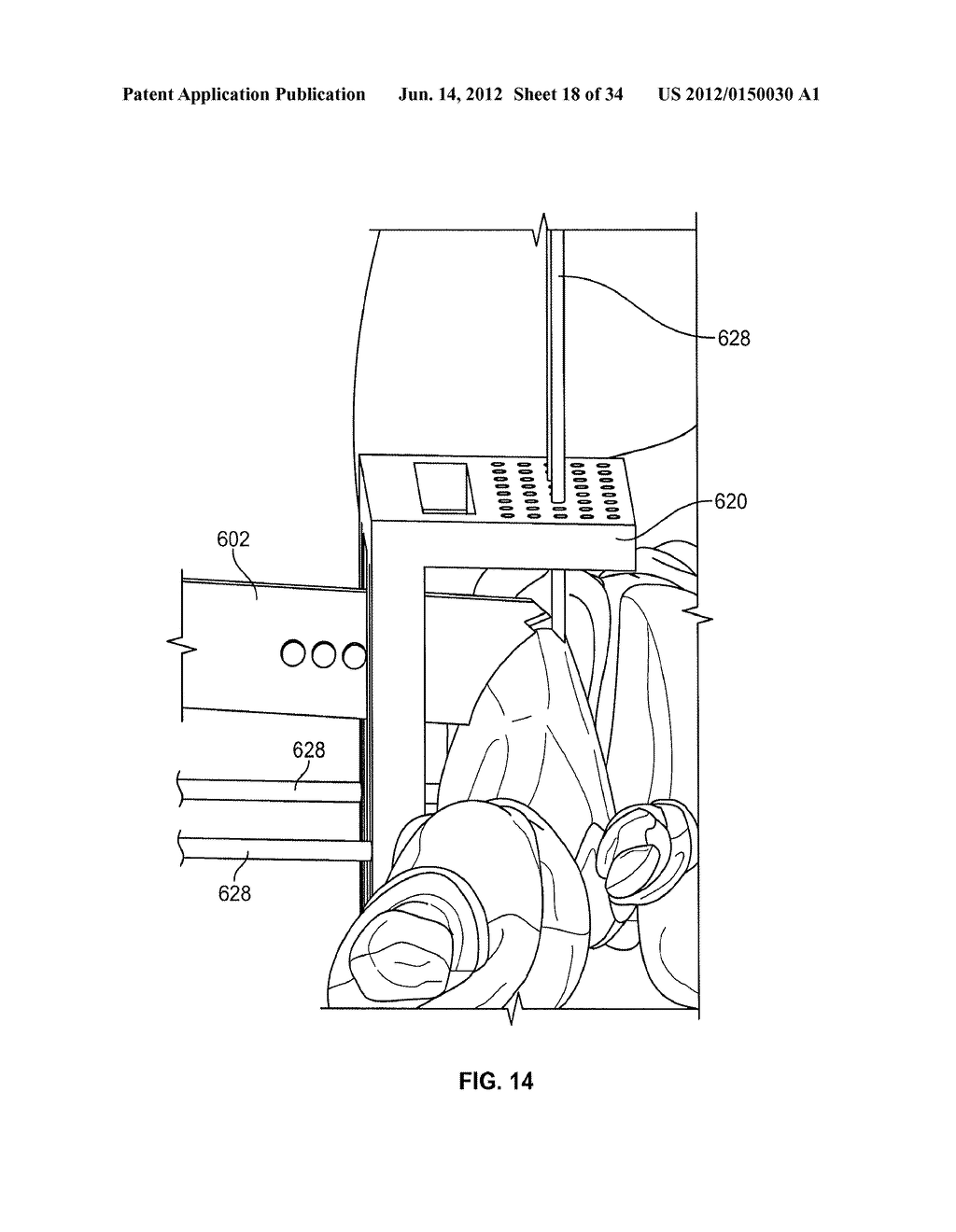 Instruments, Methods and Systems for Harvesting and Implanting Cartilage     Material - diagram, schematic, and image 19