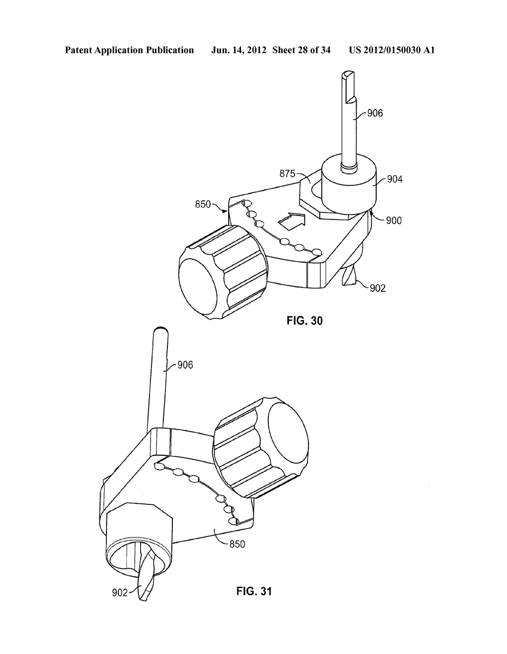 Instruments, Methods and Systems for Harvesting and Implanting Cartilage     Material - diagram, schematic, and image 29