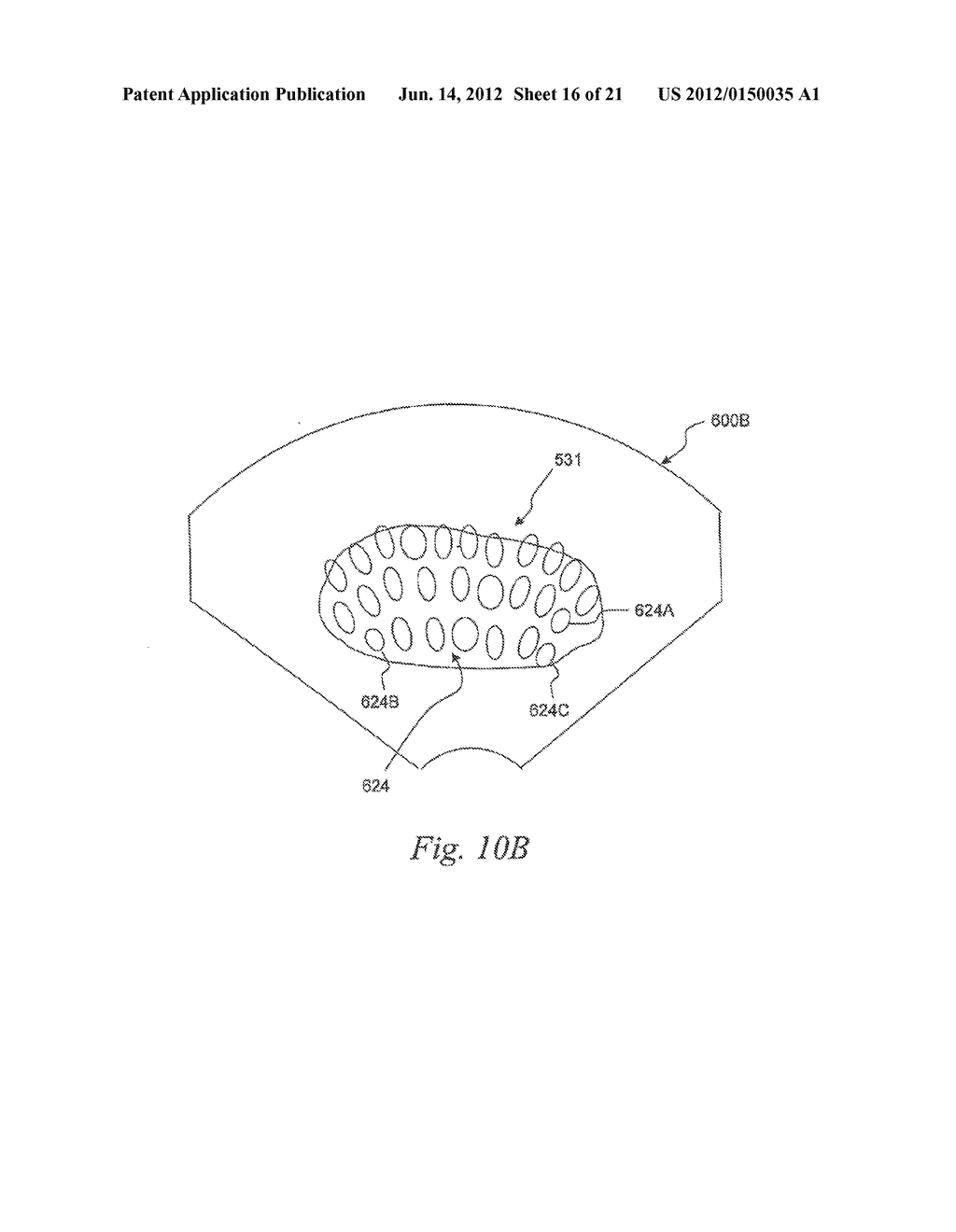 Method and Apparatus for the Selective Treatment of Tissue - diagram, schematic, and image 17