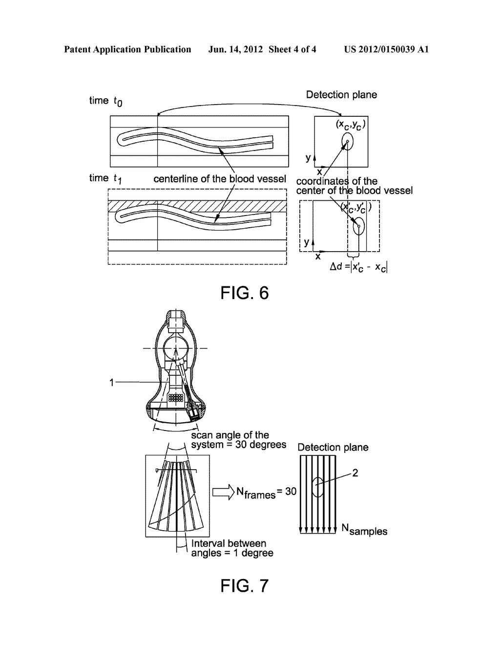 ULTRASOUND VOLUME PROBE NAVIGATION AND CONTROL METHOD AND DEVICE - diagram, schematic, and image 05