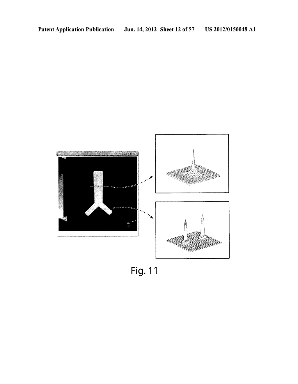 VASCULAR ANALYSIS METHODS AND APPARATUS - diagram, schematic, and image 13