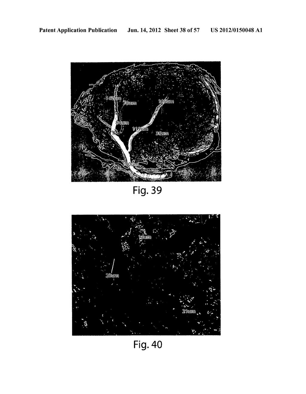 VASCULAR ANALYSIS METHODS AND APPARATUS - diagram, schematic, and image 39