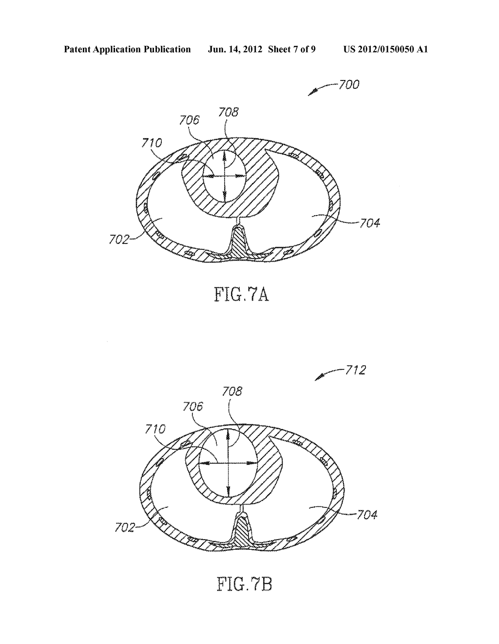 APPARATUS AND METHOD FOR ESTIMATING STROKE VOLUME OF THE HEART USING     BIO-IMPEDANCE TECHNIQUES - diagram, schematic, and image 08