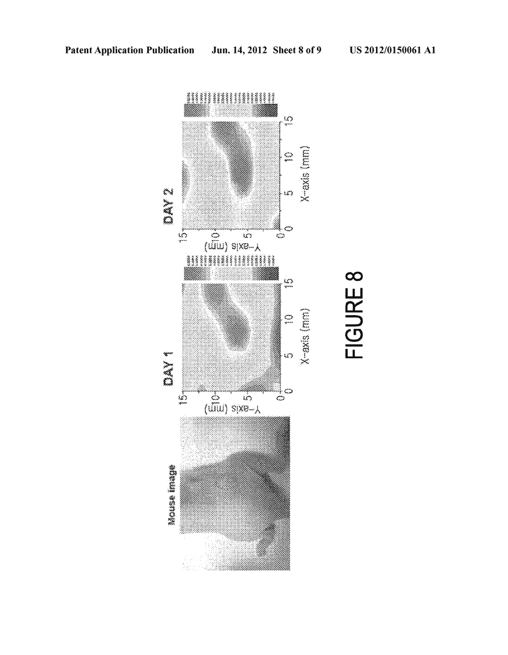 Sensor for Detecting Cancerous Tissue and Method of Manufacturing the Same - diagram, schematic, and image 09