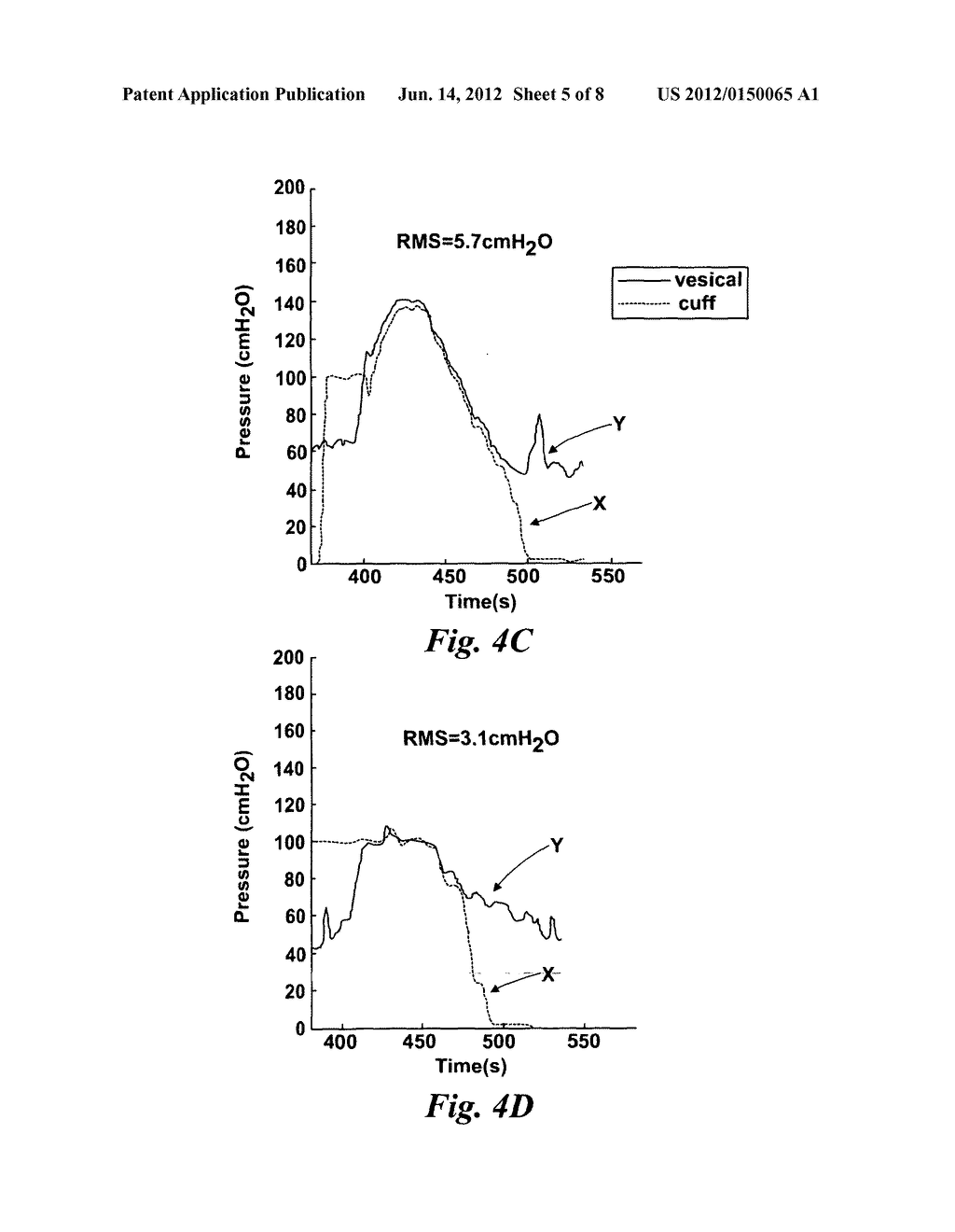 Method and Apparatus For Measuring Bladder Pressure - diagram, schematic, and image 06