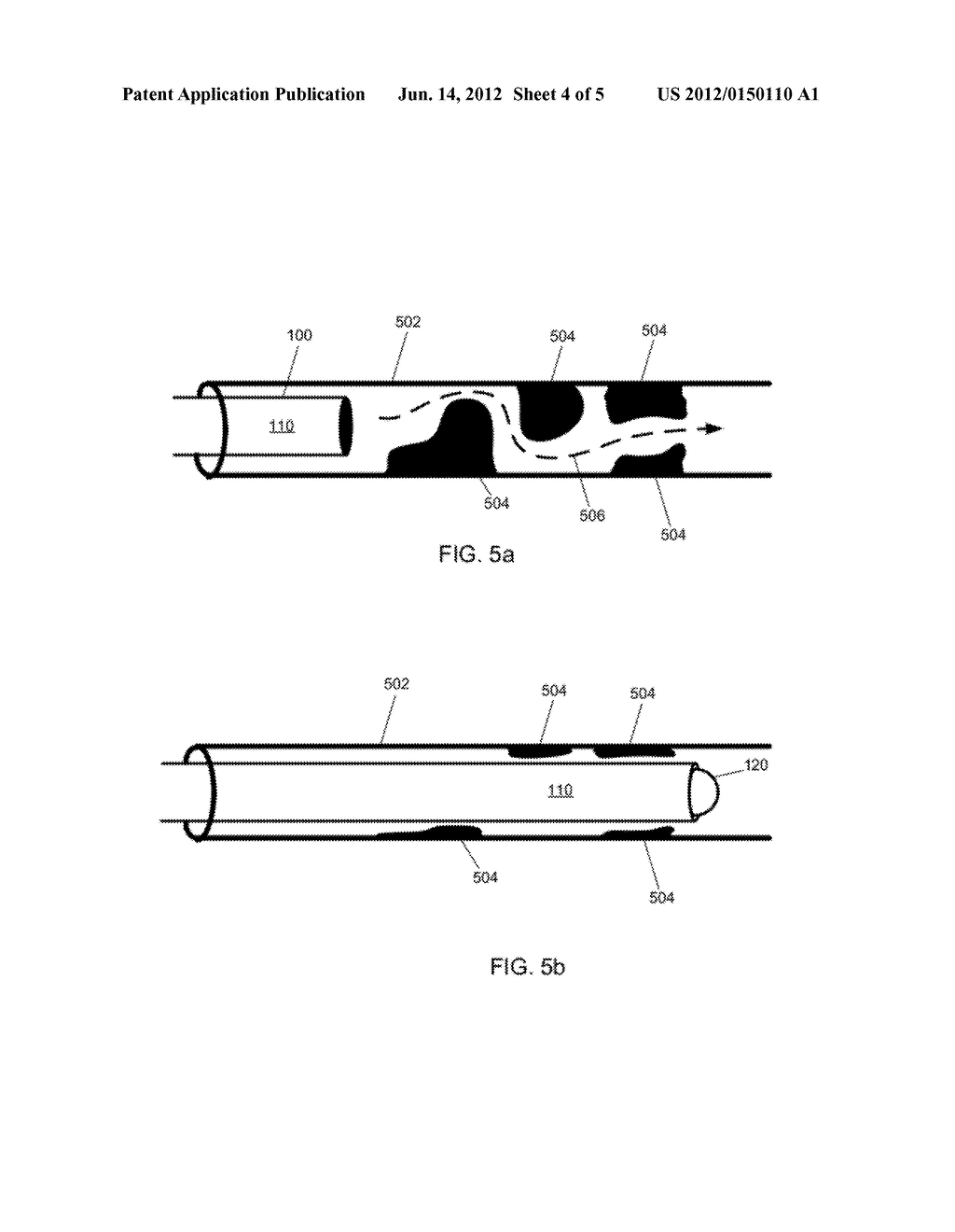 CATHETER WITH VESSEL LINING AND METHODS FOR USING SAME - diagram, schematic, and image 05