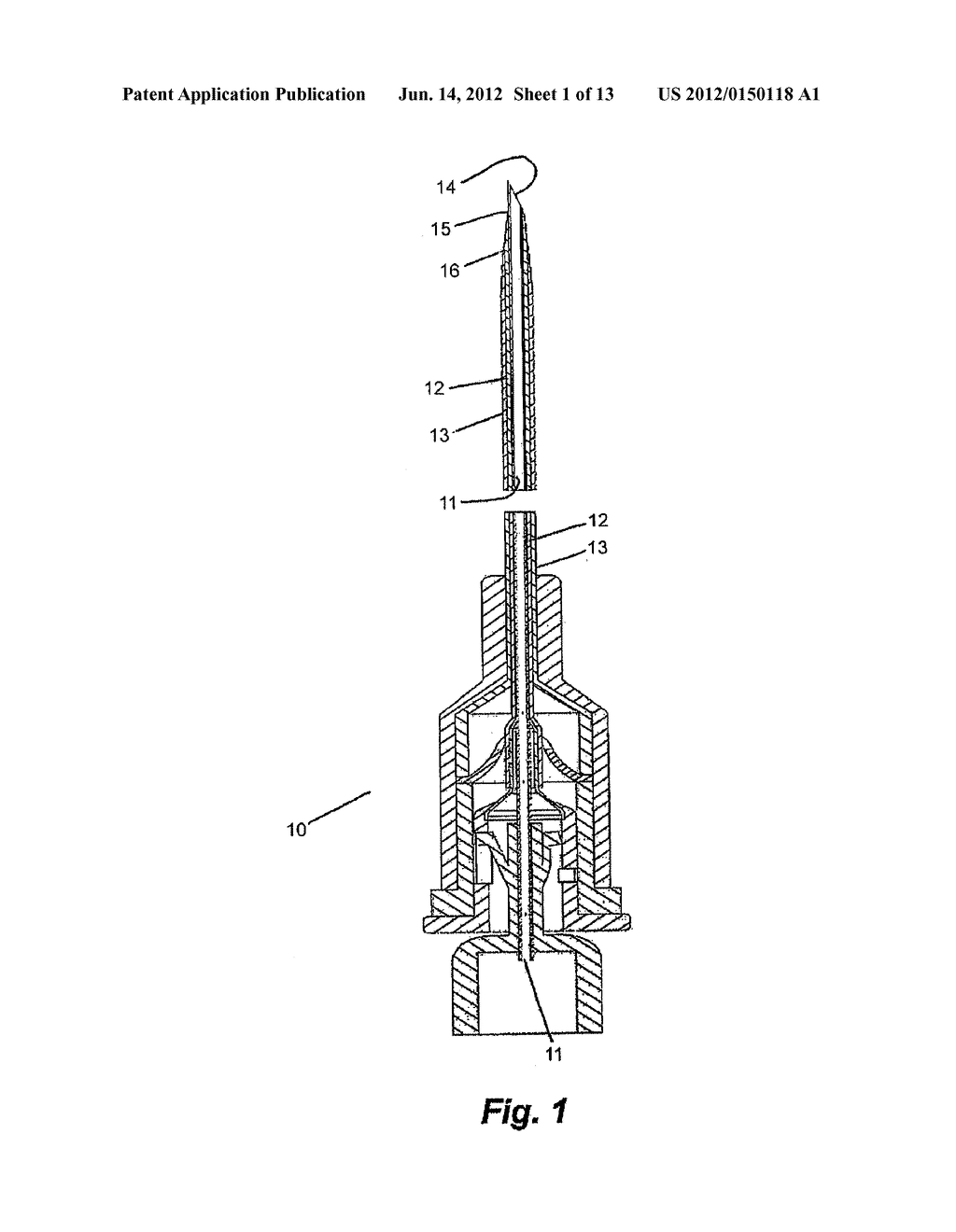 Apparatus for Peripheral Vascular Access - diagram, schematic, and image 02