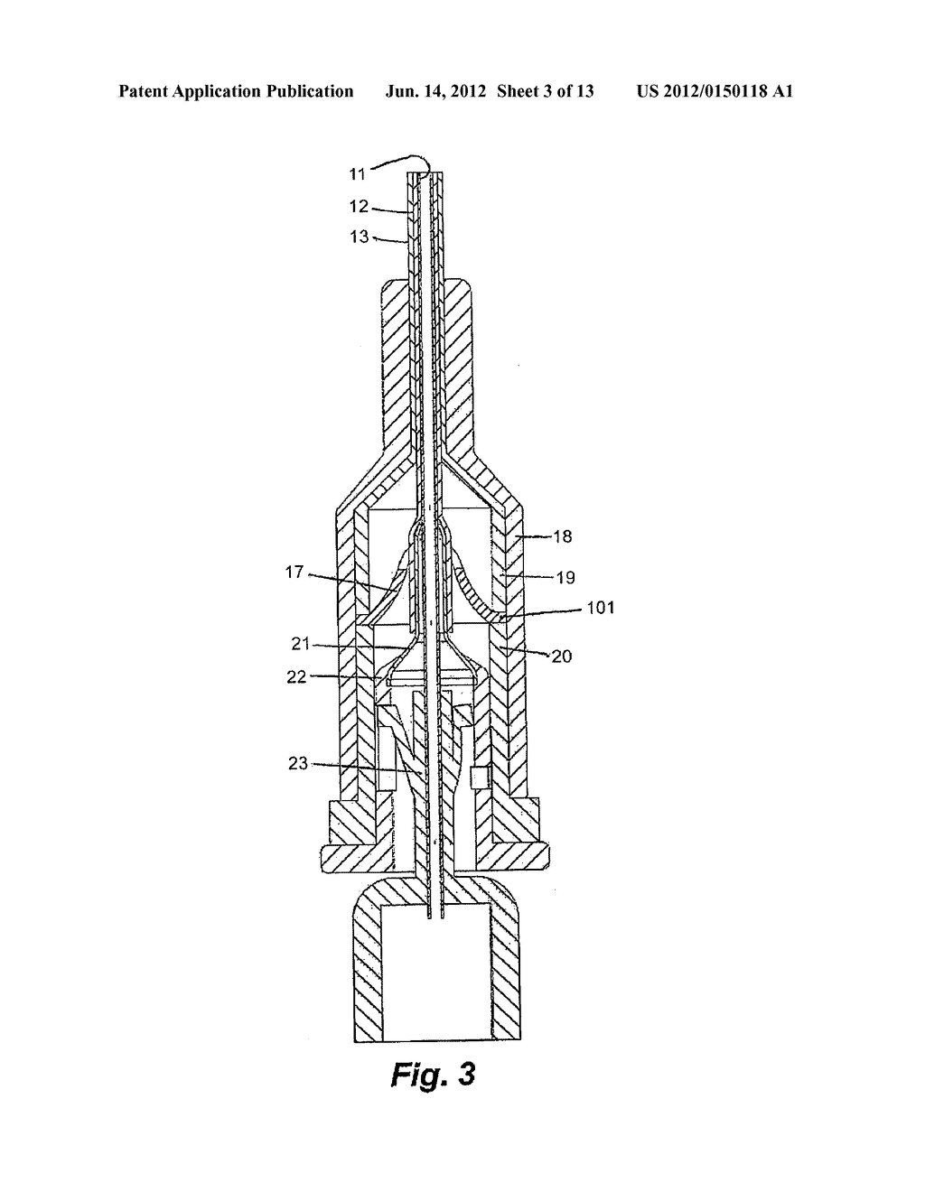 Apparatus for Peripheral Vascular Access - diagram, schematic, and image 04