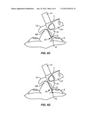 DISPOSABLE DISPENSER DROP DIVERTER diagram and image