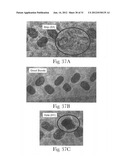 Absorbent Article With Containment Barrier diagram and image