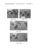 Absorbent Article With Containment Barrier diagram and image