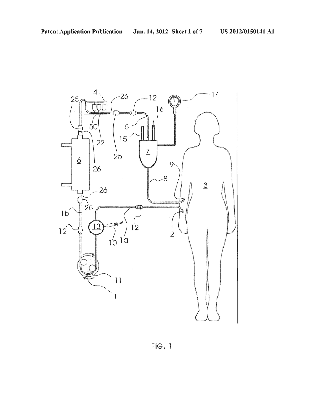 DIALYSIS MACHINE, A MANIFOLD FOR THE DIALYSIS MACHINE AND PROCESS - diagram, schematic, and image 02